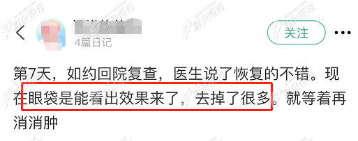 宁波美莱去眼袋真实例子