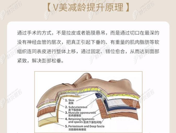 北京加减美穆宝安做拉皮手术技术好,V美减龄面部提升保持久