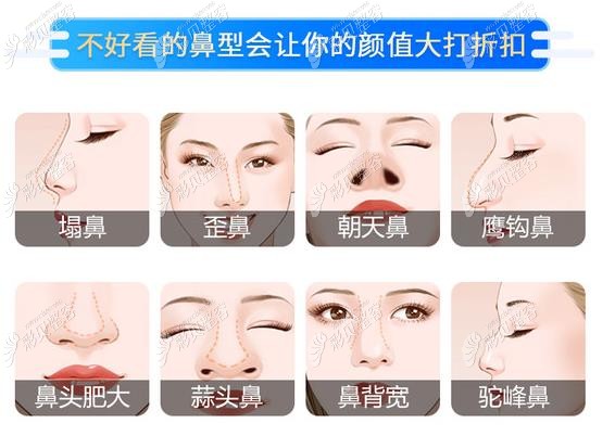 上海邱文苑医生隆鼻怎么样?做鼻子风格和评价表示挺厉害的