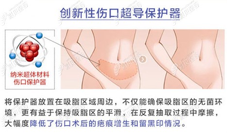 昆明韩辰王德宁医生自体脂肪填充怎么样