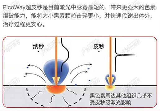 大连爱德丽格做超皮秒祛斑