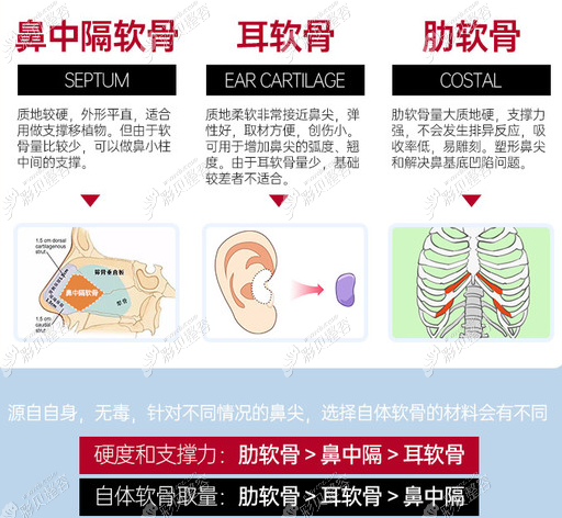 大连爱德丽格何明达医生回答你做肋骨鼻综合怎么样等问题