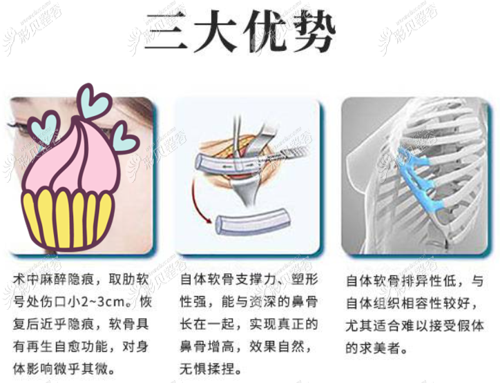 大连爱德丽格的何明达医生做肋软骨隆鼻的技术怎么样