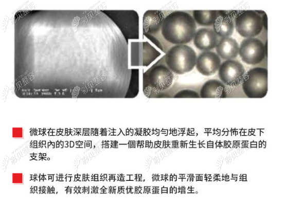 少女针有胶原蛋白增生的功效