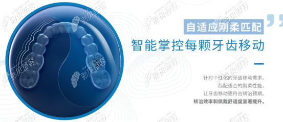 时代天使牙套的优势一