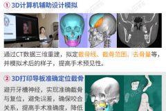 广州广大做正颌好的医生矫正左右脸不对称的手术费是多少