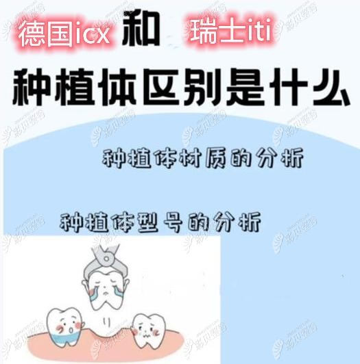 德国icx和瑞士iti种植体哪个好