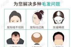 深圳正规植发医院哪个比较好?请看公办和毛发专科机构名单