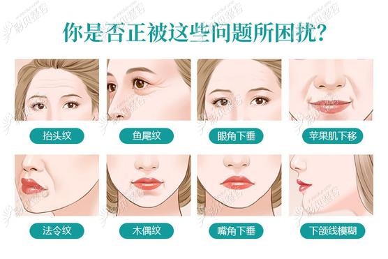 面部拉皮手术可以改善的面部松弛问题