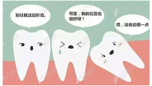智齿影响牙齿整齐