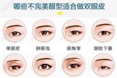 杭州做双眼皮修复比较好的医院给出了做眼综合的价格参考