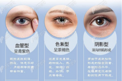杭州去黑眼圈和眼袋需要多少钱,想去除它们哪种方法比较好