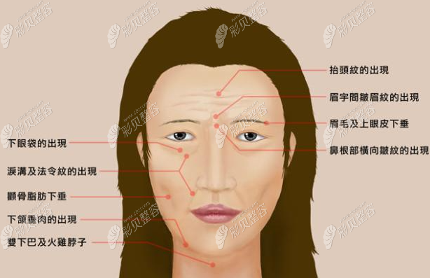 面部皱纹图