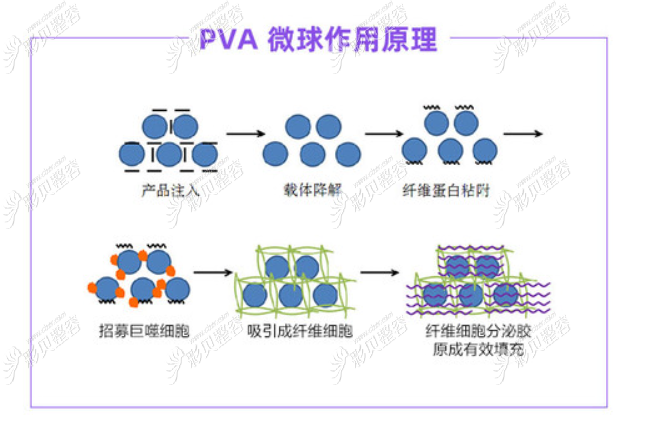 宝尼达长效玻尿酸PVA微球作用原理