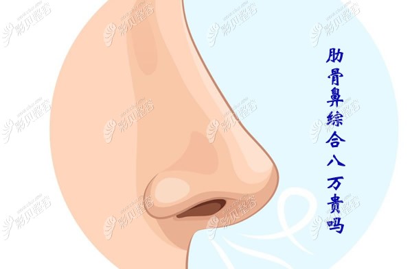 做个肋骨鼻综合8万贵吗