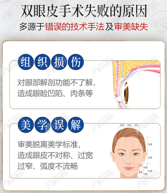 双眼皮失败的原因跟医生技术有很大关系