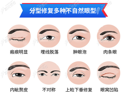 需要修复的眼睛有哪些