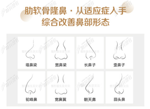 昆明梦想整形李成龙医生做自体肋软骨隆鼻怎么样 昆明梦想整形李成龙医生做自体肋软骨隆鼻怎么样