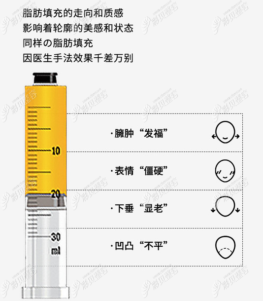 脂肪填充跟医生技术有很大关系