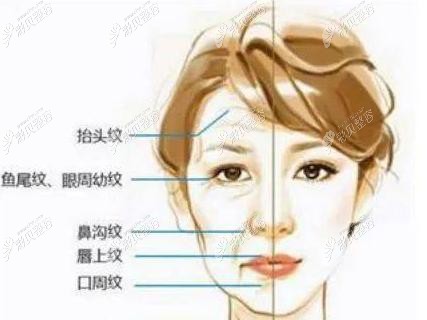 速拉美和V美减龄哪个好?区别有哪些 速拉美和V美减龄哪个好?区别有哪些