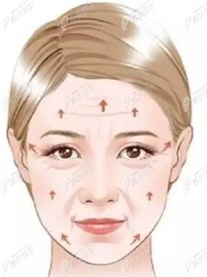 速拉美提升是什么原理呢 速拉美提升是什么原理呢