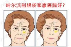 哈尔滨去眼袋技术好的医院推荐了擅长超声眼袋消除的医生