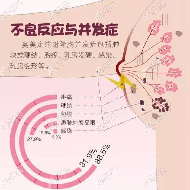 广州做胸部奥美定取出多少钱？要清奥技术厉害的正规医院