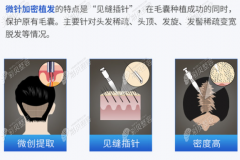 深圳哪里有好的植发医院，要种头发水平高但费用便宜的