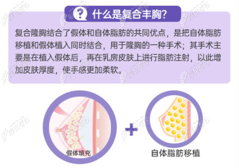 什么是复合隆胸