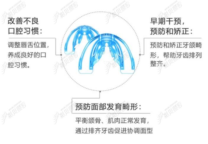 MRC早期干预矫治器的优点介绍
