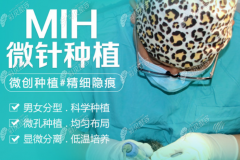 广州有名的植发医院除公办外,私立专门种发机构也值得推荐