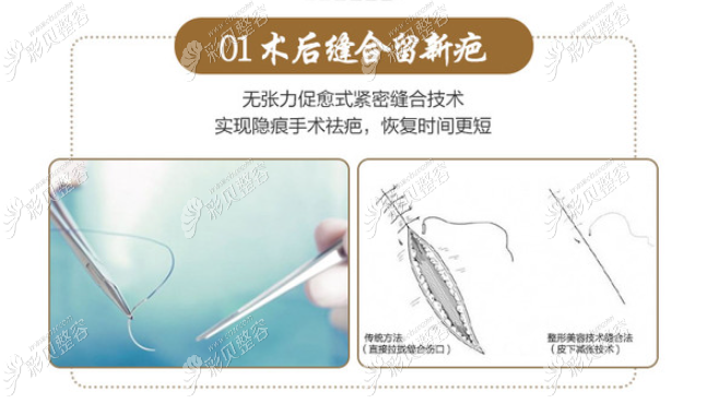 深圳鹏程医院疤痕科靠谱吗