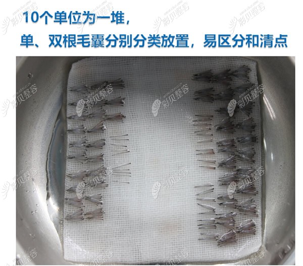 提取的毛囊数量怎么计算