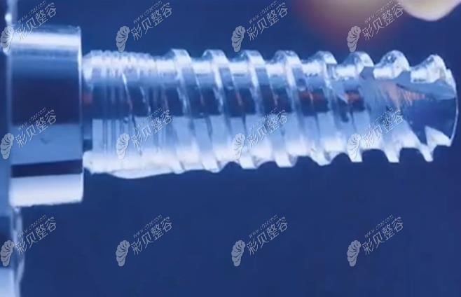 德国朗斯种植体外观图片