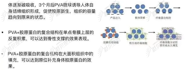 PVA的作用机理