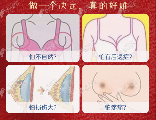 做假体隆胸选择正规医院及技术好的医生很重要
