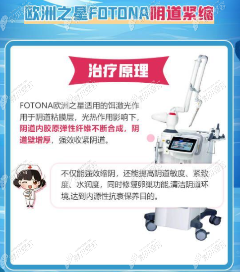 欧洲之星fotona治疗阴道紧致的原理 欧洲之星fotona治疗阴道紧致的原理