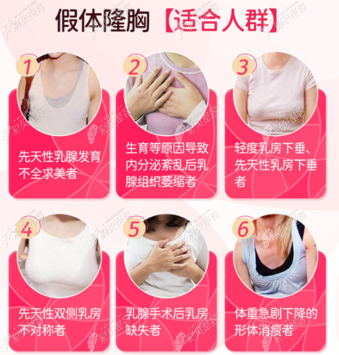 银川硅胶隆胸医院哪家便宜,产后想做妙桃假体手术大概费用