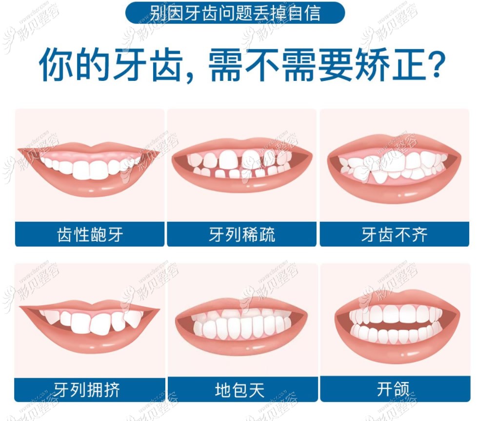 哪些牙齿需要矫正