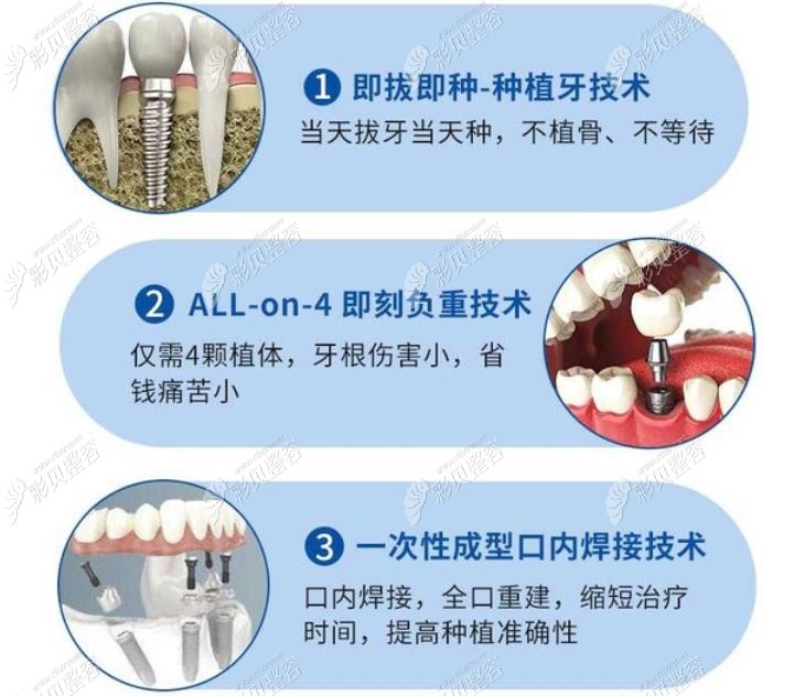 武汉五洲美莱口腔医院种植牙怎么样？all on 4即刻种植技术优势