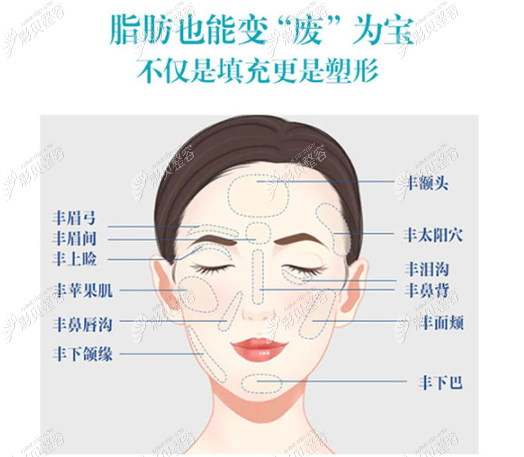 为啥做全脸脂肪填充7天后还是肿大,是我没戴面罩的原因吗