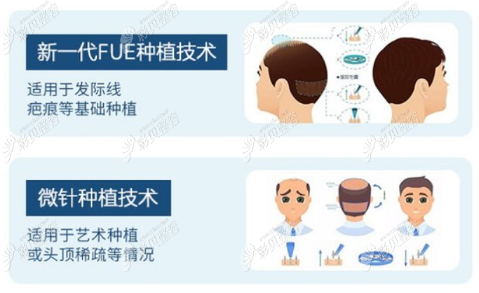 FUE微针植发技术一毛囊单位多少钱