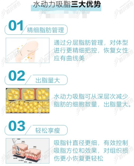 郭广科、逢宝峰医生用水动力吸小腿的优势