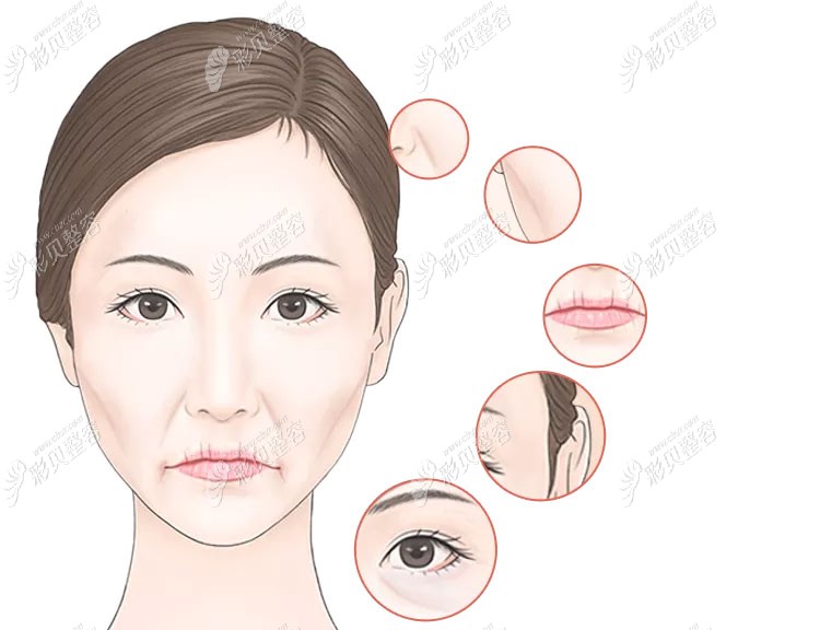 V美减龄V9改善全脸的皱纹问题
