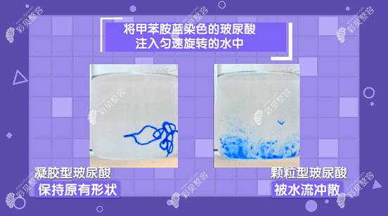 凝胶型玻尿酸隆鼻怎么样 凝胶型玻尿酸隆鼻怎么样