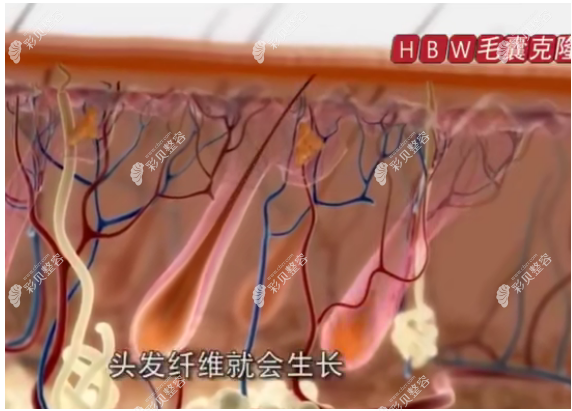 毛囊克隆技术最新动态图片