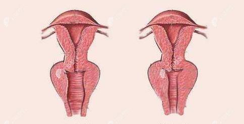 做3d生物束带紧缩术能缩到几指