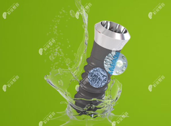 糖尿病人适合种瑞士iti亲水型种植体