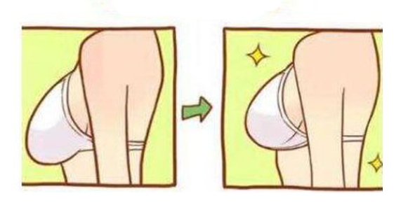 胸部下垂程度标准示意图