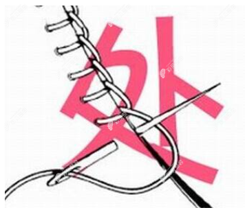 乌鲁木齐处女膜修复多少钱